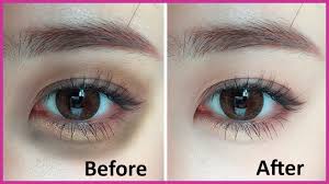 Image result for Remove Under Eye Dark Circles Instantly