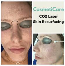 before and after co2 laser skin resurfacing