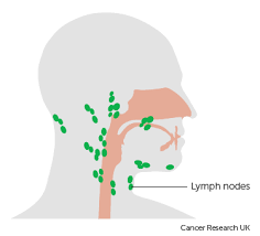 Surgery To Remove The Lymph Nodes In Your Neck Mouth