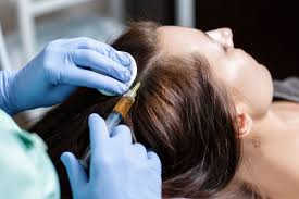 trying prp injection for hair loss