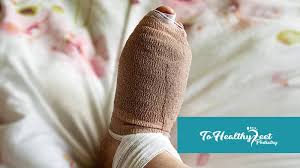 hammer toe surgery and recovery what
