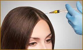 مراحل درمانی مزوتراپی مو و مزایای و معایب آن چیست؟ - کلینیک مو جلوه ماندگار