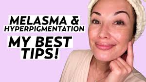 hyperpigmentation e skin skincare