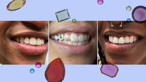 tooth gem trend