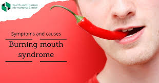 burning mouth syndrome treatment at