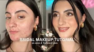 bridal makeup tutorial on acne