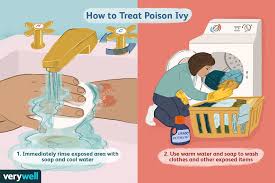 poison ivy symptoms treatment
