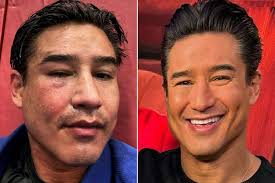 mario lopez shares before and after