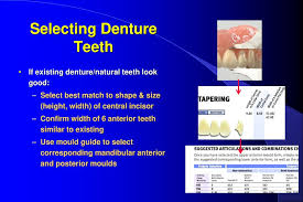 Selecting Denture Teeth Ppt Download