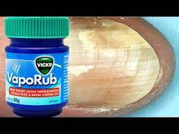 treat toenail fungus with vicks vaporub