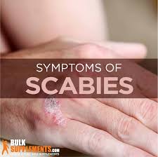 scabies symptoms causes treatment