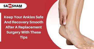 ankles safe and recovery smooth