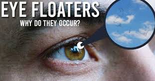 eye floaters why do they occur