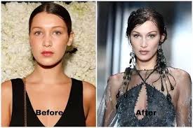 how bella hadid lost 20 pounds fabbon