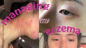 grwm for eczema e skin skincare
