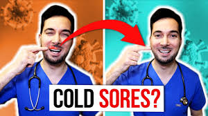 cold sores on lips fast and treatment