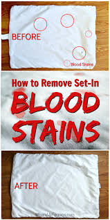 This simple method works well to remove blood stains from clothes, sheets, carpets and upholstery. How To Remove Dried Set In Blood Stains From Clothes
