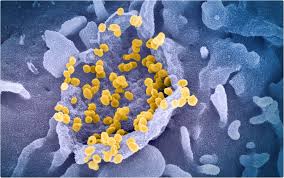 Jun 16, 2021 · in lateinamerika breitet sich eine neue variante des coronavirus aus. Lambda Lineage Of Sars Cov 2 Has Potential To Become Variant Of Concern