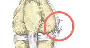 al knee pain inside symptoms