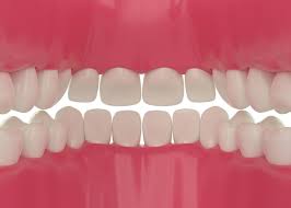 aligned healthy white teeth 3d ilration