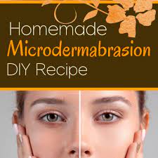 homemade microdermabrasion treatment