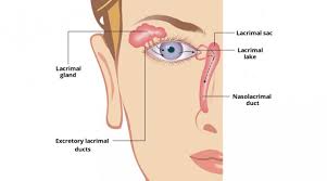 what is lacrimal lake treatment obn