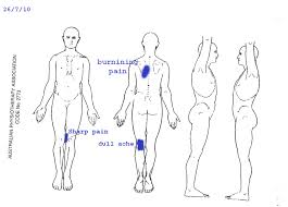 Clinical Reasoning Cyclist Jay Kay