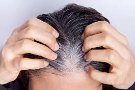 Une coupe de cheveux qui arrive au niveau de la mandibule est idéale pour les femmes de 50 ans. Alopecie Calvitie Pelade 10 Mythes Et Realites Sur La Perte De Cheveux Huffpost Quebec Vivre