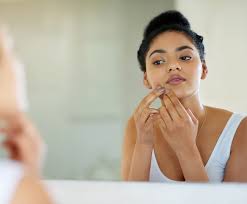 how to get rid of cystic acne for good