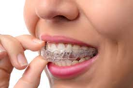 It is not uncommon to experience pain when you start using braces. Tips To Reduce Invisalign Pain Minerva Oh Dowell Dental Group
