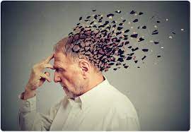 Alzheimer disease is characterized by a progressive and irreversible decline in memory and deterioration of other cognitive abilities. Sex And Alzheimer S Disease