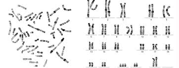 Check spelling or type a new query. Karyotyping
