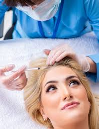 hair restoration with keralase in