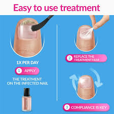 excilor ultra fungal nail treatment