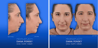 ponsky plastic surgery