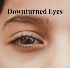 understanding downturned eyes causes