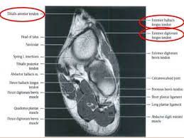 Head, neck, arm, foot, pelvis, etc. Foot Radiological Anatomy Shorouk Zaki