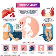 Hypertension, proteinuria, renal damage and even chronic renal failure, which requires dialysis treatment in a significant number of adults. Preeclampsia Eclampsia Nursing Maternity Review
