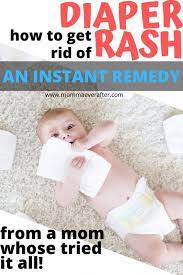 diaper rash remedy for severe rashes
