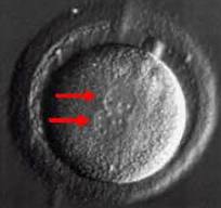 ‪Pictures of IVF embryos from our in vitro fertilization ...‬‏
