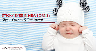 sticky eye in newborn signs causes
