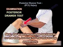 posterior drawer test pcl injury