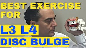 best exercise for l3 l4 disc bulge l3