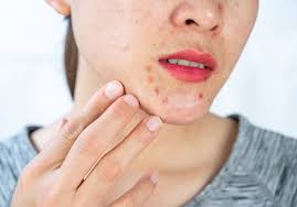 red spots on skin causes treatment