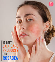 15 best skincare s for rosacea