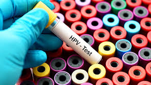 Hpv is not a new virus. Updated Cervical Cancer Screening Guidelines Emphasize Hpv Testing Md Anderson Cancer Center