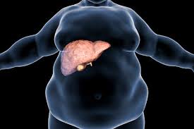 Image result for metabolic disorders images