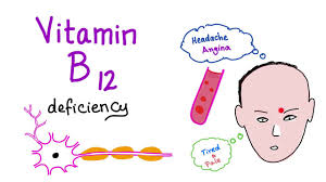 Vitamin B12 Cobalamin Deficiency Causes Symptoms Diagnosis Management