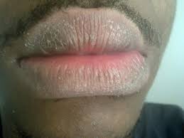 health warnings your lips are trying to