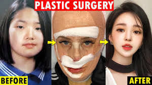 10 korean actresses plastic surgery